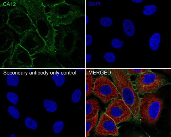 Carbonic Anhydrase XII Antibody in Immunocytochemistry (ICC/IF)
