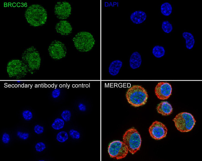 BRCC3 Antibody in Immunocytochemistry (ICC/IF)