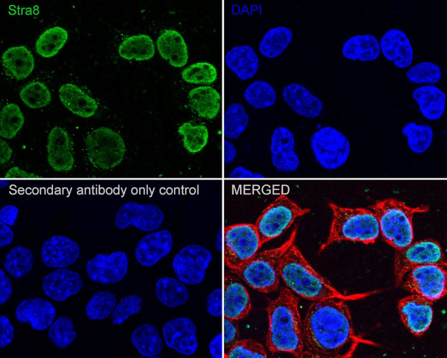 STRA8 Antibody in Immunocytochemistry (ICC/IF)