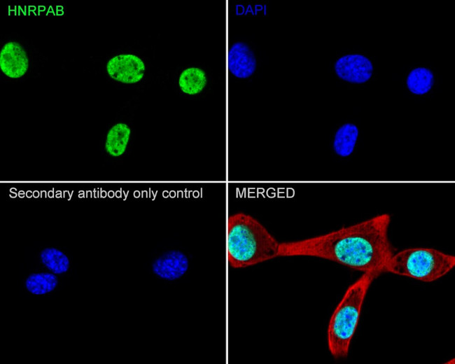 hnRNP AB Antibody in Immunocytochemistry (ICC/IF)