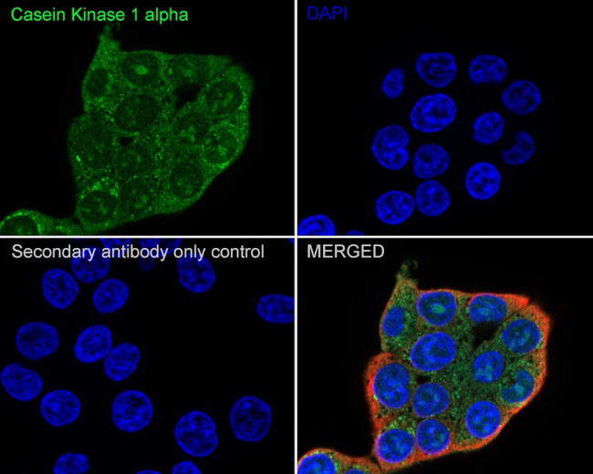 CK1 alpha Antibody in Immunocytochemistry (ICC/IF)