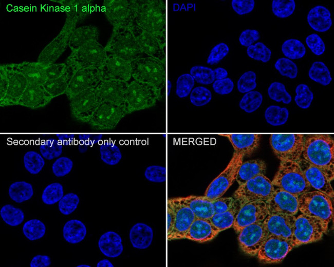 CSNK1A1/CSNK1A1L Antibody in Immunocytochemistry (ICC/IF)