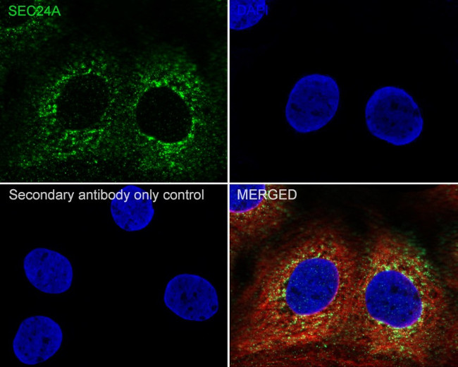 SEC24A Antibody in Immunocytochemistry (ICC/IF)