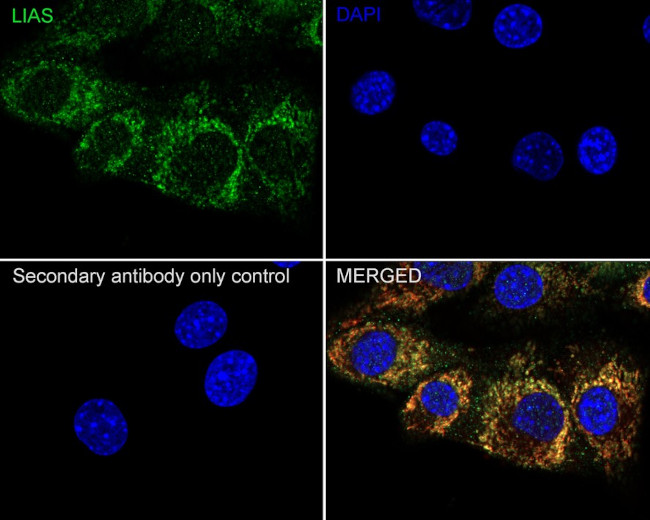 LIAS Antibody in Immunocytochemistry (ICC/IF)