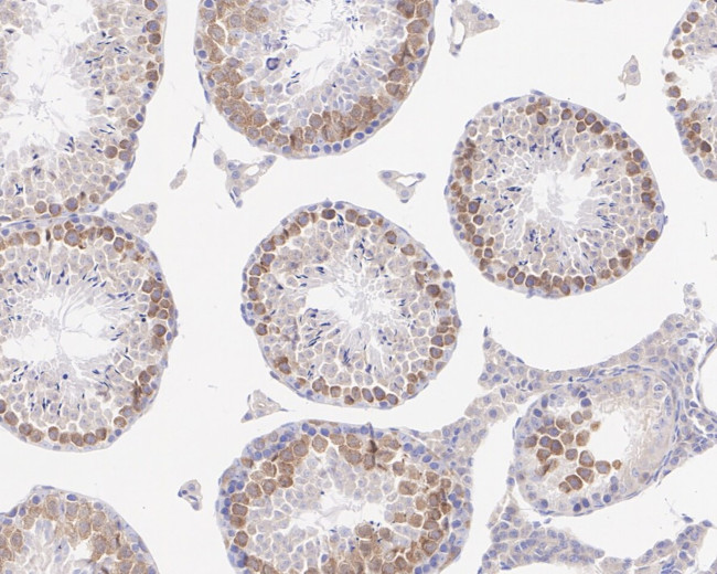 SAV1 Antibody in Immunohistochemistry (Paraffin) (IHC (P))