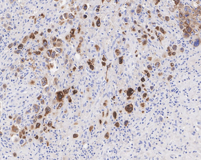 CD30 Antibody in Immunohistochemistry (Paraffin) (IHC (P))
