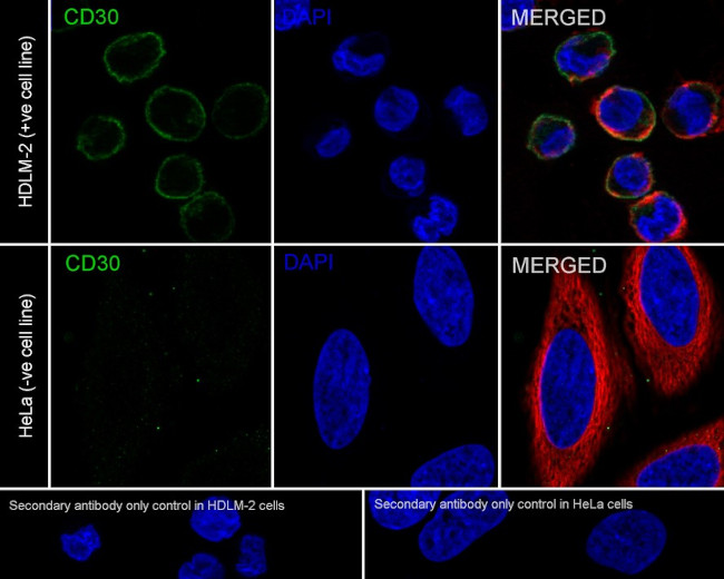 CD30 Antibody in Immunocytochemistry (ICC/IF)