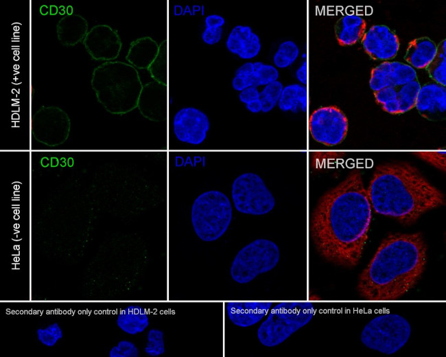 CD30 Antibody in Immunocytochemistry (ICC/IF)
