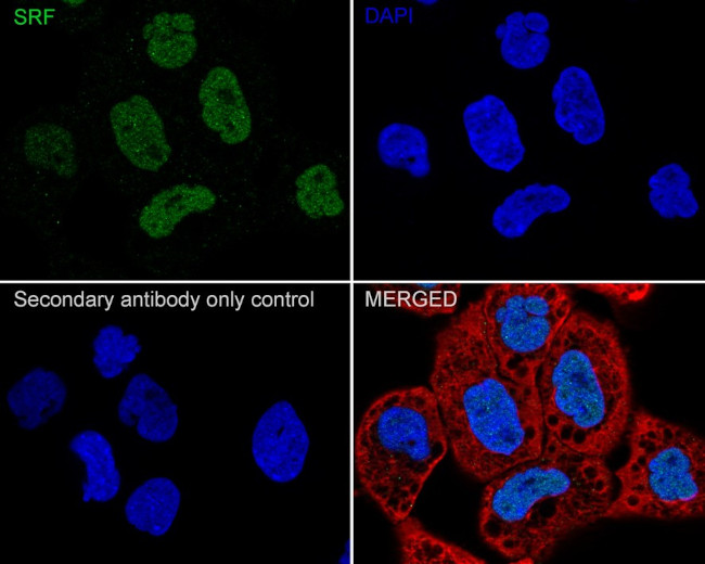 SRF Antibody in Immunocytochemistry (ICC/IF)