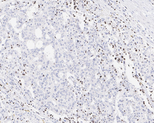 NCOA4 Antibody in Immunohistochemistry (Paraffin) (IHC (P))