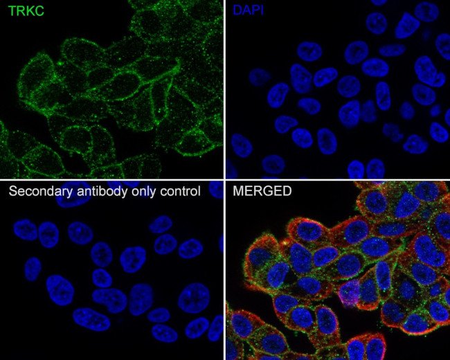 TrkC Antibody in Immunocytochemistry (ICC/IF)