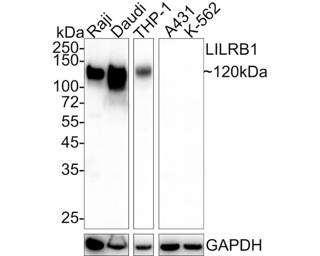 CD85j (ILT2) Antibody in Western Blot (WB)