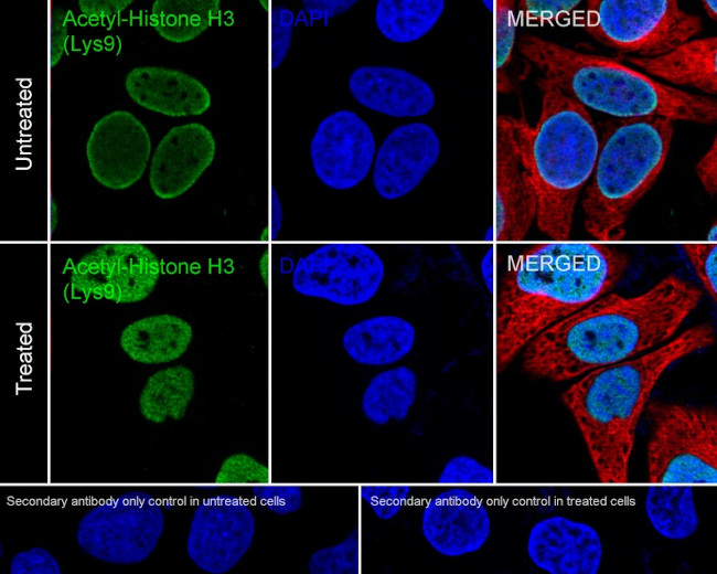 H3K9ac Antibody in Immunocytochemistry (ICC/IF)