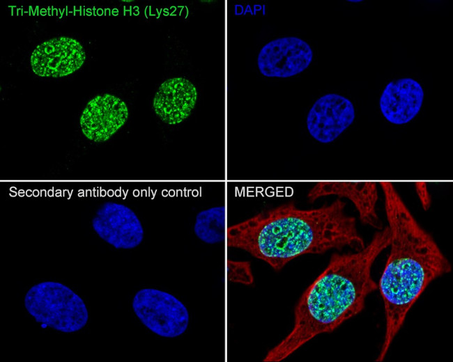 H3K27me3 Antibody in Immunocytochemistry (ICC/IF)