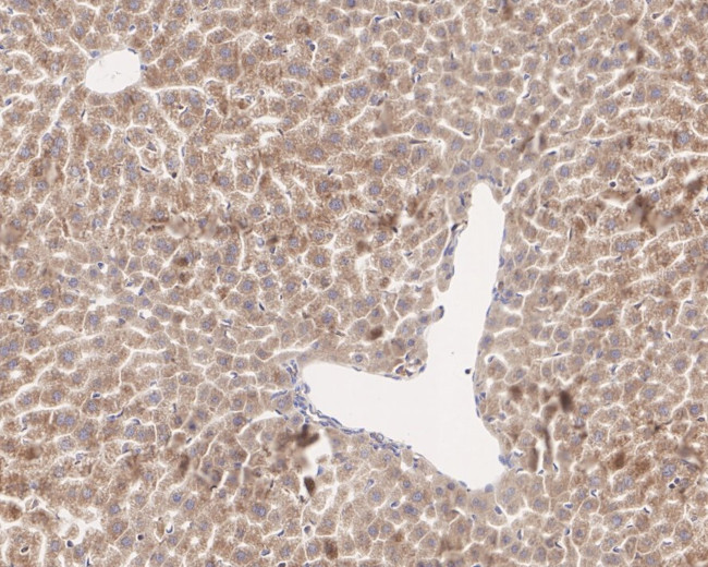 CTU2 Antibody in Immunohistochemistry (Paraffin) (IHC (P))