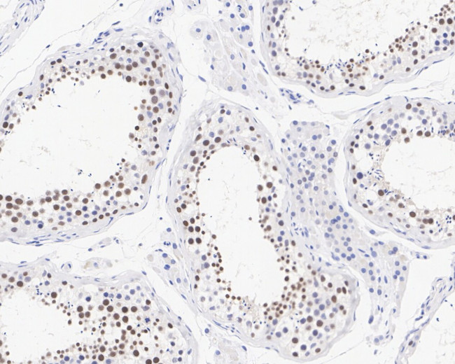 POLL Antibody in Immunohistochemistry (Paraffin) (IHC (P))