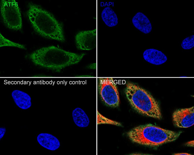 ATF6 Antibody in Immunocytochemistry (ICC/IF)