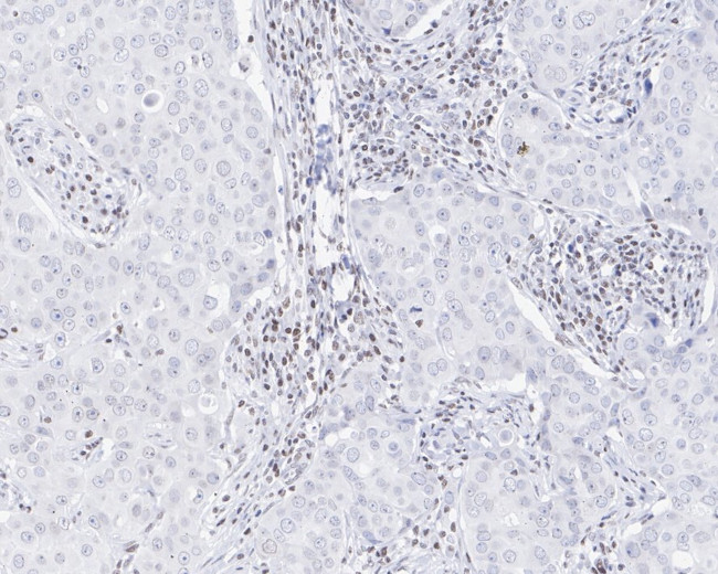 SMCHD1 Antibody in Immunohistochemistry (Paraffin) (IHC (P))