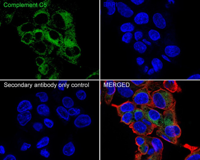 Complement C5 Antibody in Immunocytochemistry (ICC/IF)