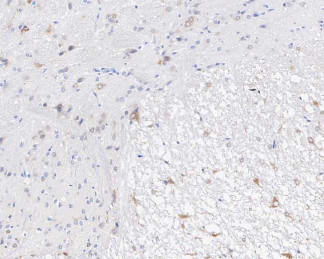 LNP Antibody in Immunohistochemistry (Paraffin) (IHC (P))