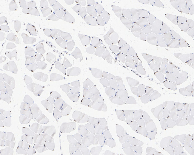 TEF1 Antibody in Immunohistochemistry (Paraffin) (IHC (P))