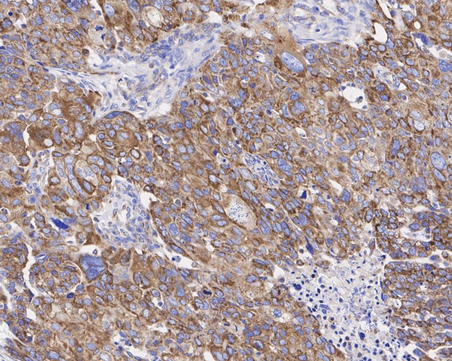 CPT1A Antibody in Immunohistochemistry (Paraffin) (IHC (P))