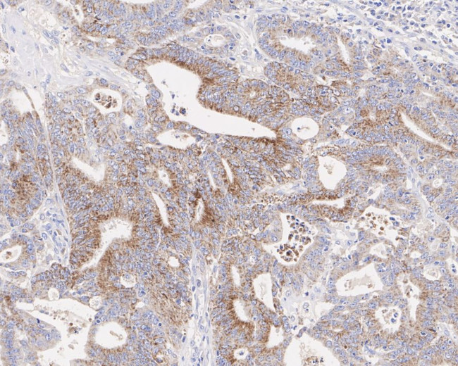 MAOA Antibody in Immunohistochemistry (Paraffin) (IHC (P))