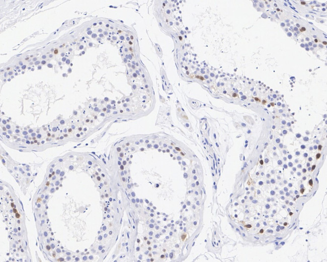 WEE1 Antibody in Immunohistochemistry (Paraffin) (IHC (P))