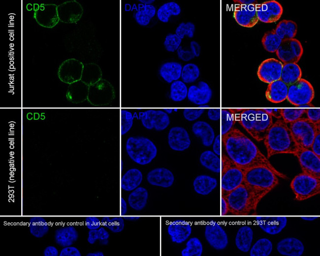 CD5 Antibody in Immunocytochemistry (ICC/IF)