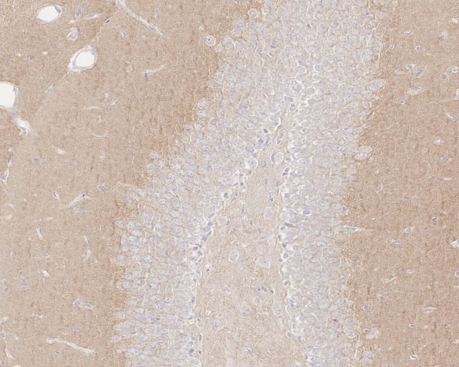 NMDAR2B Antibody in Immunohistochemistry (Paraffin) (IHC (P))
