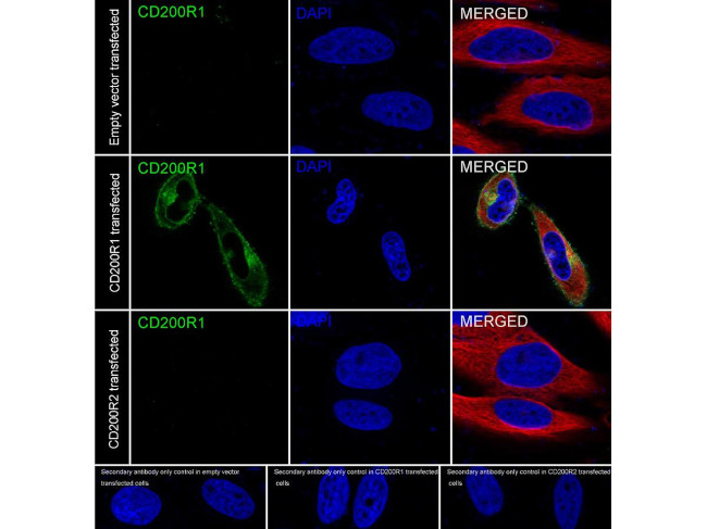 CD200R Antibody in Immunocytochemistry (ICC/IF)