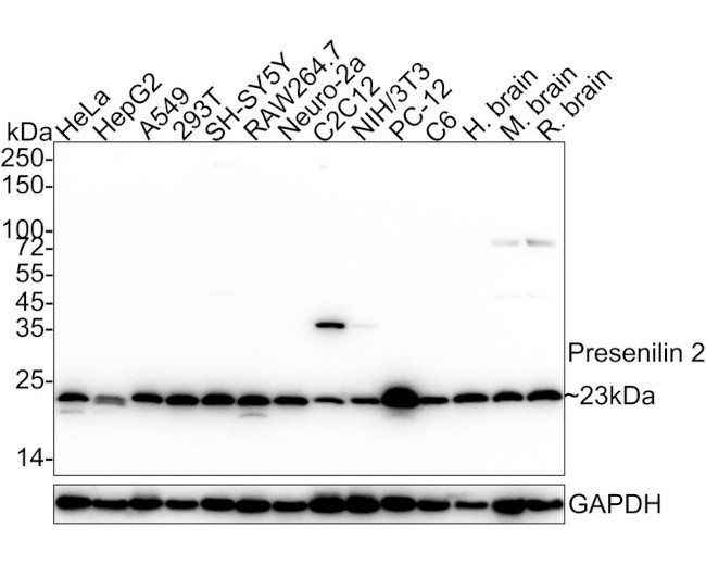 PSEN2 Antibody in Western Blot (WB)