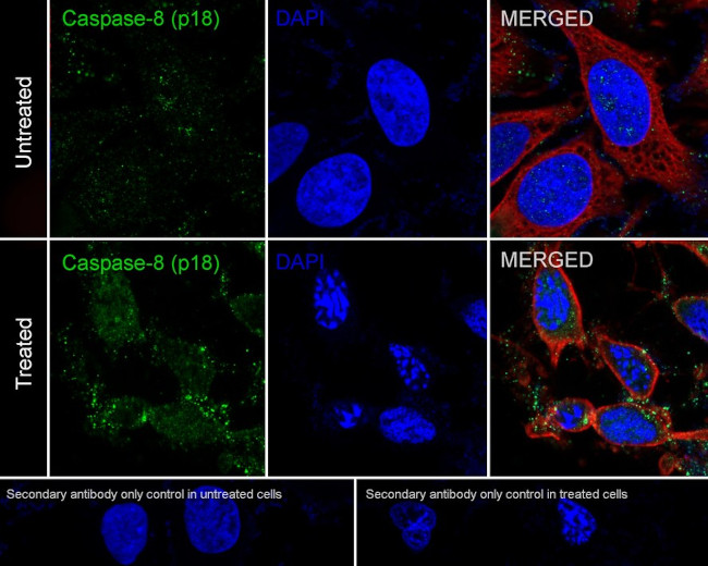 Caspase 8 Antibody in Immunocytochemistry (ICC/IF)