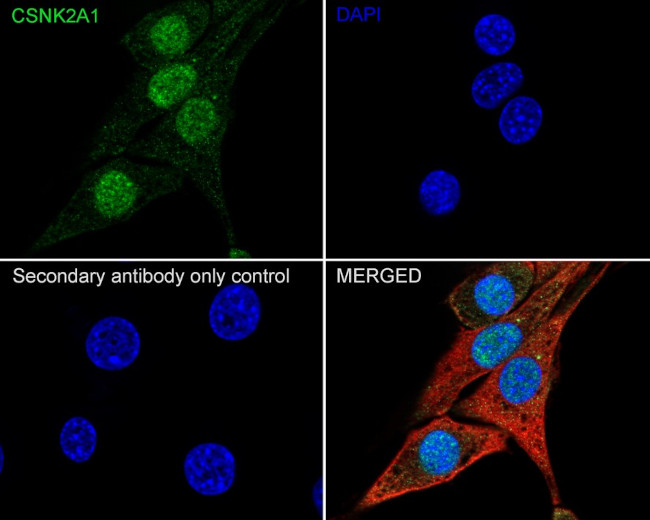 CK2 alpha-1 Antibody in Immunocytochemistry (ICC/IF)