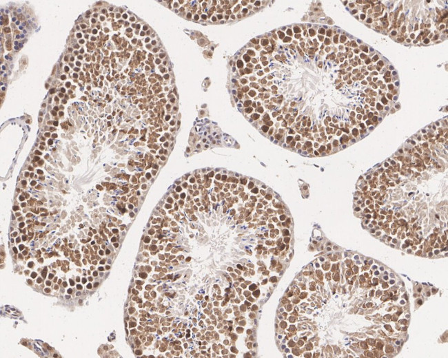 HDJ2 Antibody in Immunohistochemistry (Paraffin) (IHC (P))