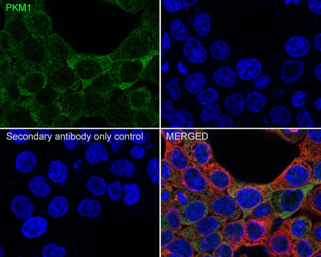 PKM1 Antibody in Immunocytochemistry (ICC/IF)