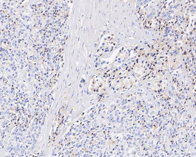 Apolipoprotein J Antibody in Immunohistochemistry (Paraffin) (IHC (P))