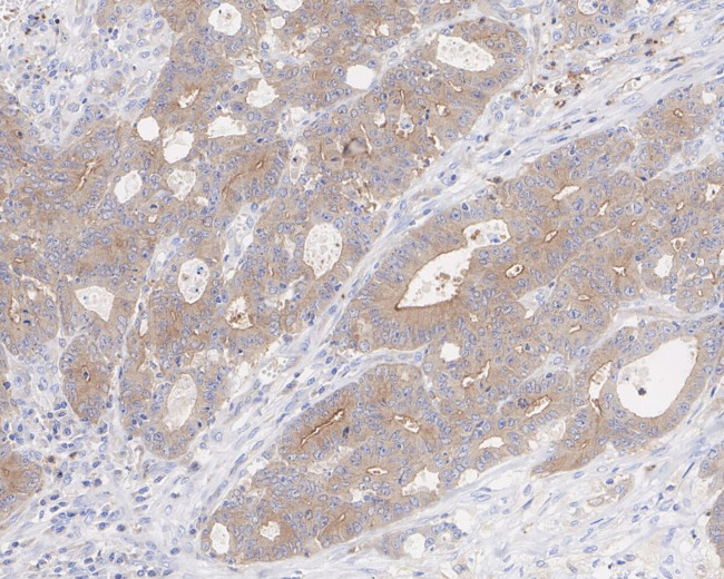 RIP3 Antibody in Immunohistochemistry (Paraffin) (IHC (P))
