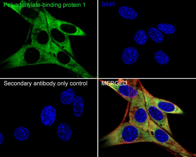 PABP Antibody in Immunocytochemistry (ICC/IF)