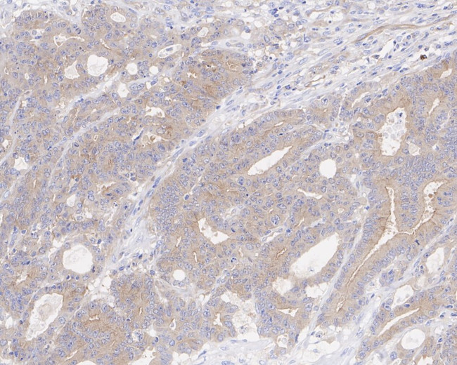 RIP3 Antibody in Immunohistochemistry (Paraffin) (IHC (P))