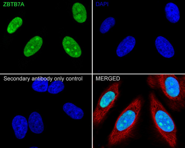 Pokemon Antibody in Immunocytochemistry (ICC/IF)
