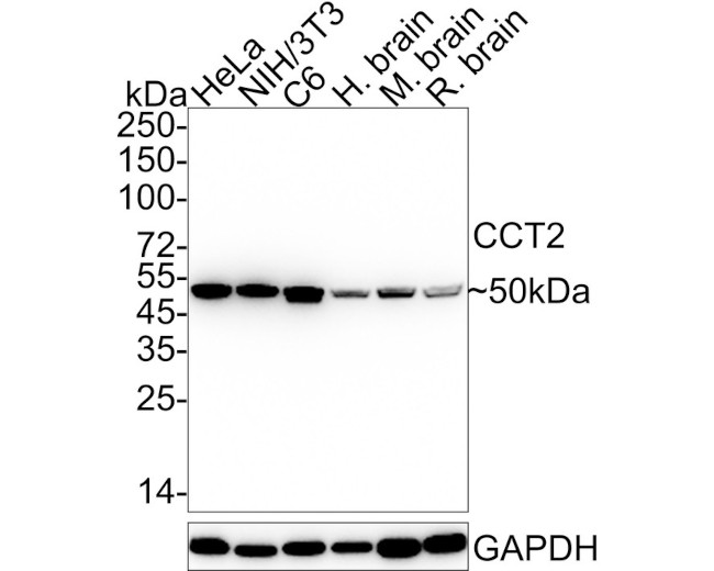 TCP-1 beta Antibody in Western Blot (WB)