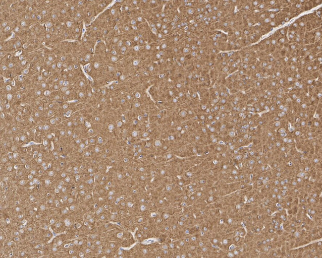 Dynamin 1 Antibody in Immunohistochemistry (Paraffin) (IHC (P))