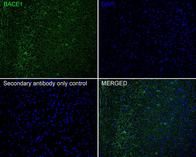 BACE1 Antibody in Immunohistochemistry (Paraffin) (IHC (P))