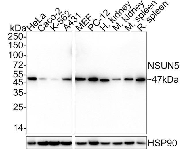 NSUN5 Antibody in Western Blot (WB)