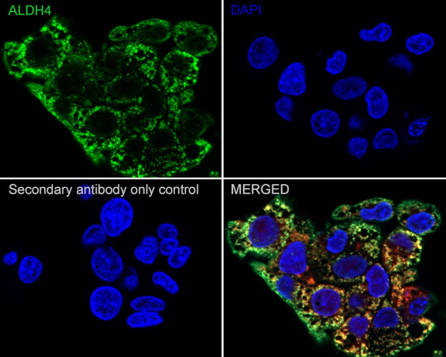 ALDH4A1 Antibody in Immunocytochemistry (ICC/IF)