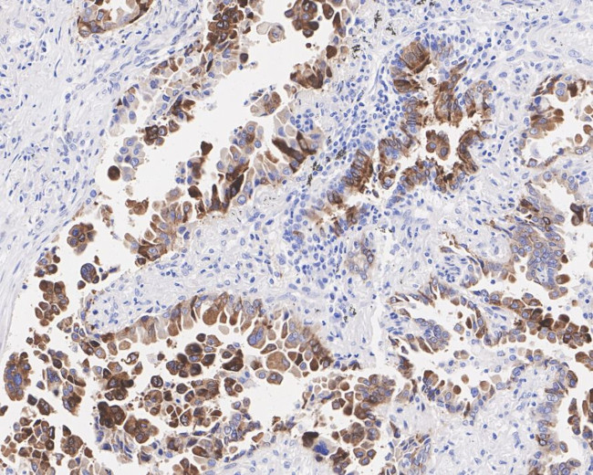 IMP3 Antibody in Immunohistochemistry (Paraffin) (IHC (P))