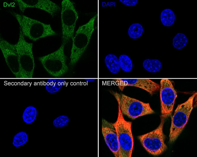 DVL2 Antibody in Immunocytochemistry (ICC/IF)