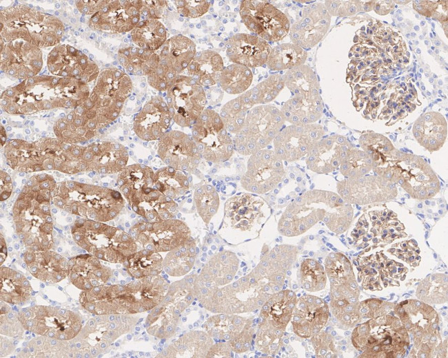 Tau Antibody in Immunohistochemistry (Paraffin) (IHC (P))