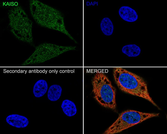 Kaiso Antibody in Immunocytochemistry (ICC/IF)